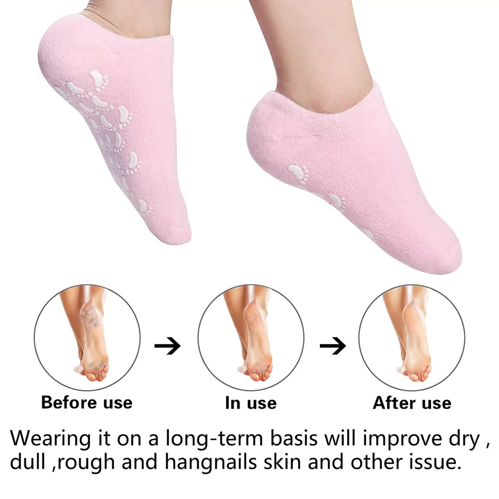 جوراب سیلیکونی ویتامینه FEETIFIX